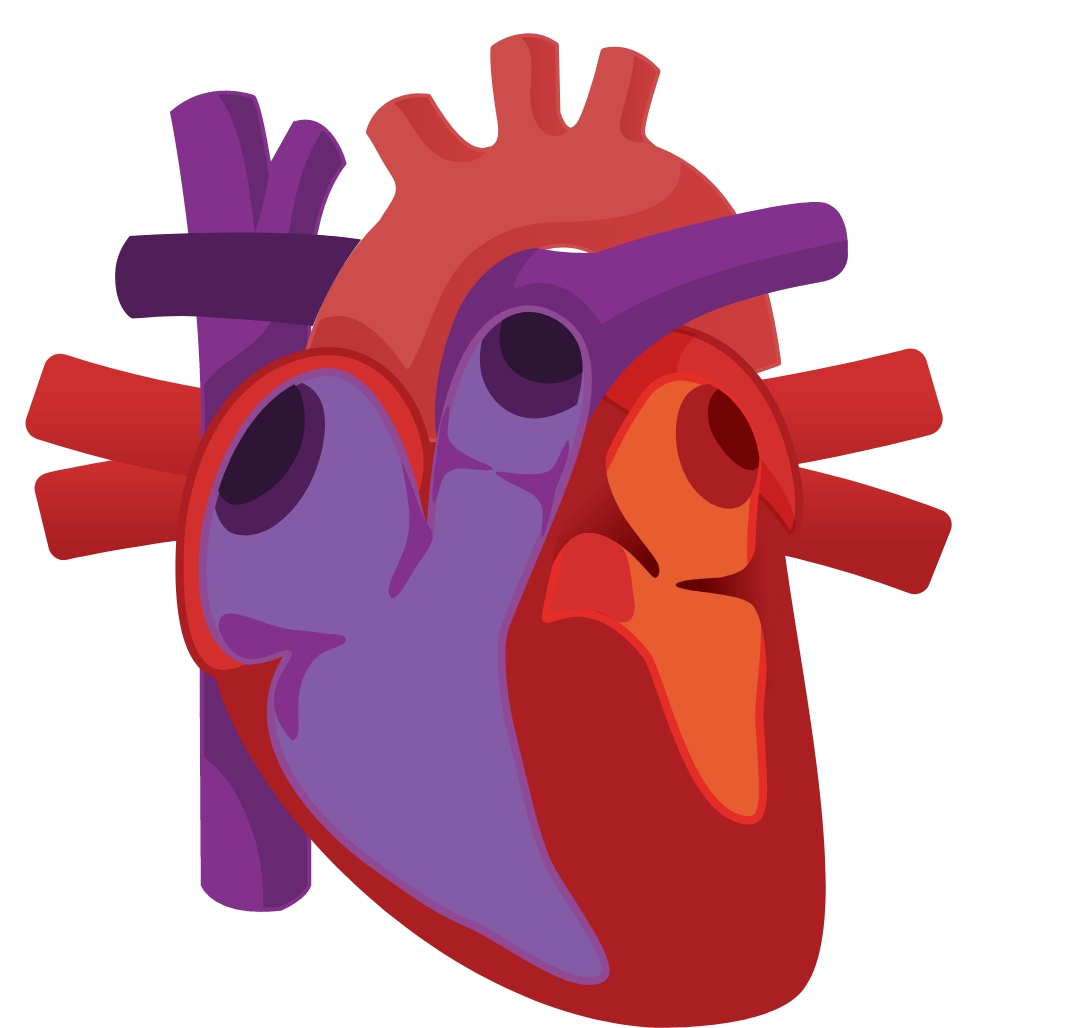  Heart Graphic Showing HCM